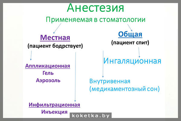 Виды анестезии в стоматологии