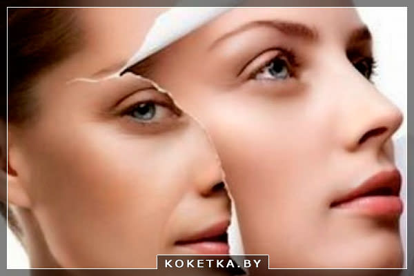 Омоложение кожи лица: операция или плазмотерапия?