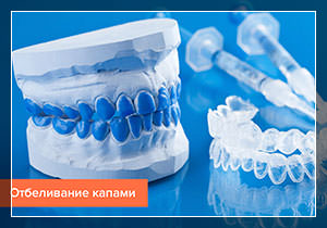 Отбеливание зубов дома