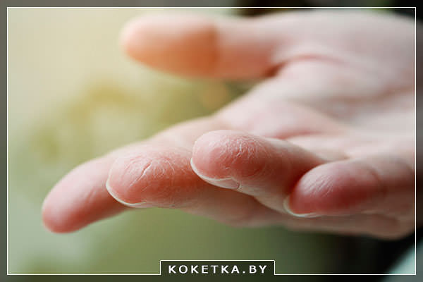 Народные рецепты от сухости кожи рук