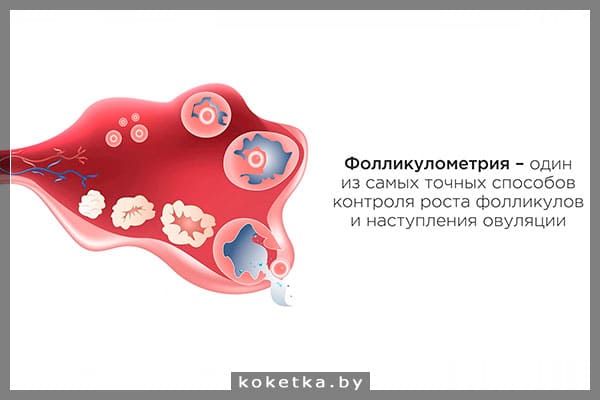 Фолликулометрия